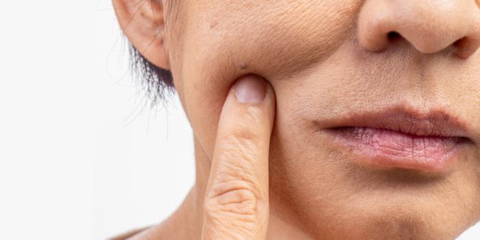 Gezonde huid - Supplementen voor beauty from within